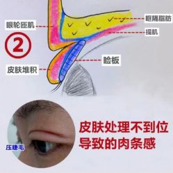 -丰联丽格医疗美容·联合丽格眼整形中心