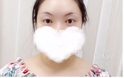 -MOE BEAUTY.皮肤管理中心