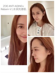 -紫御国际抗衰ZOE ANTI AGING