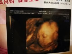 -杭州天目山妇产医院