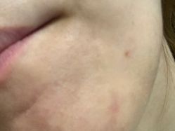 -SKINIST丽铂医疗美容