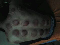 -中医推拿(永兴佳园店)