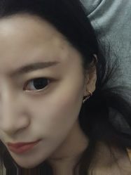 -南京健丽·去眼袋医疗美容机构