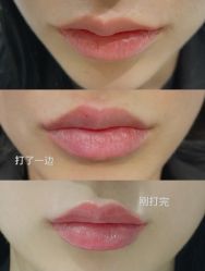 -上海漾颜医疗美容