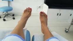 -派恩宜灰指甲鸡眼嵌甲手足癣