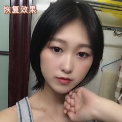 点击看大图 -新生植发·植养护一体