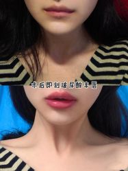 -上海漾颜医疗美容