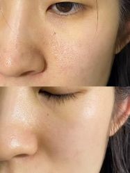 -彼家美创·量肤定制修护管理