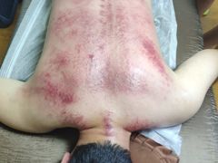 -沈师傅盲人按摩工作室(密三小区店)