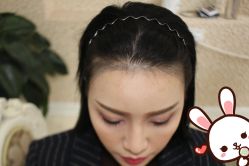 -大麦微针植发丨全国连锁