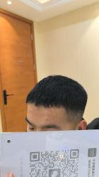 -碧莲盛·不剃发植发