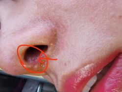 点击看大图 -厦门美莱整形美容医院