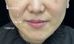 点击看大图 -Yestar 嘉兴艺星医疗美容医院