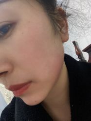 -丰联丽格医疗美容·联合丽格眼整形中心