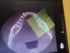 -成都市第一人民医院(南区)