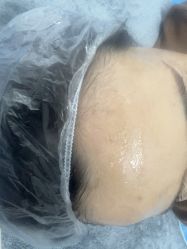 -长沙雅美医疗美容医院