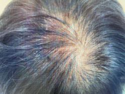 -雍禾植发全国连锁