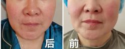 -LUNA皮相美·骨相美高级美感
