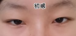 -八大处整形