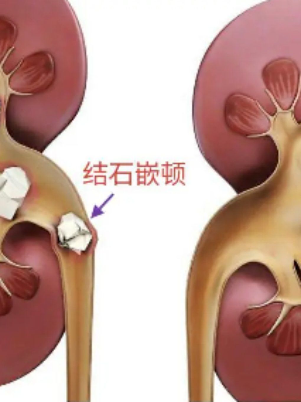 【健康科普】急腹症