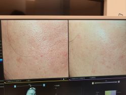 -苑苑vbeauty科技美容SPA
