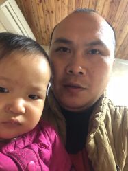 -大麦微针植发丨全国连锁