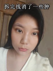 -素美医疗美容·西南眼鼻整形·修复基地