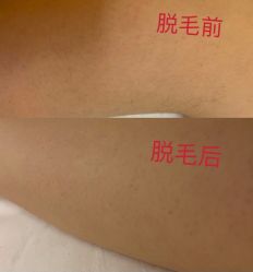 -嘉和医学脱毛中心