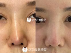 -北京米扬丽格医疗美容·联合丽格鼻整形中心