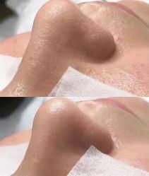 -+MS卓美丝专业祛痘·皮肤管理中心