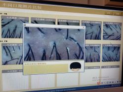 -丝客富脱发养发头皮馆