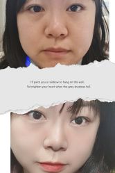 体验前-坤如玛丽·医疗美容中心