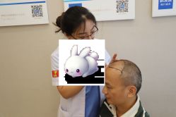 -大麦微针植发丨全国连锁