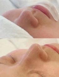 -海菲秀·飞顿牛奶光·LDM官方授权中心美轮美浣瓷感美肌