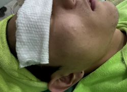 -苗医生0感祛痘连锁