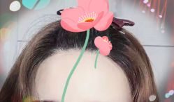 -大麦微针植发全国连锁