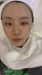 体验后-恒妍医美·韩国定制抗衰中心