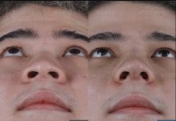 -北京米扬丽格医疗美容·联合丽格鼻整形中心