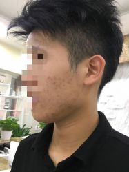 点击看大图 -痘博士广州·全国连锁祛痘机构