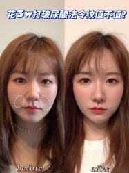 -大华韩艺整形美容医院