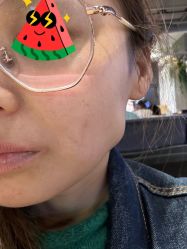 -More摩尔医美の注射线雕光电中心