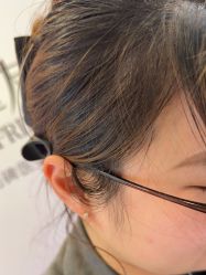 -长沙雅美医疗美容医院