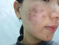 -蕾特恩专业祛痘·皮肤管理