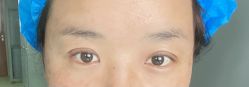-成都西区医院整形美容