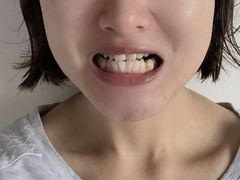 -极光口腔·矫正种植修复(锦江店)