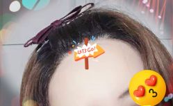 -大麦微针植发全国连锁