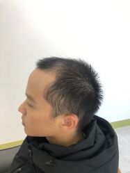 -发饰美男士增发补发假发定制店