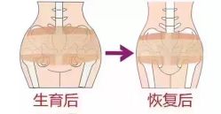 -美丽妈妈产后恢复中心(城西力盟国芳店)