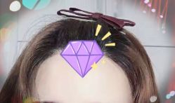 -大麦微针植发全国连锁