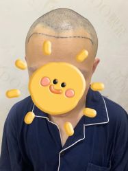 -熙朵美学植发·连锁品牌